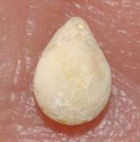 Terebratula carnea var elongata
